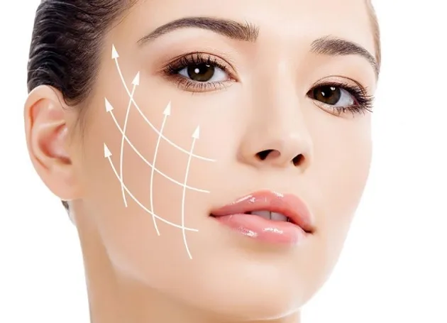 threadlift