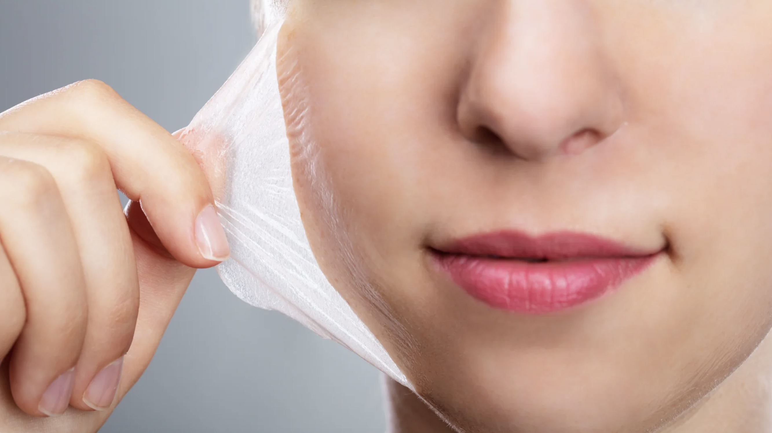 chemical peels