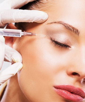 dermafillers