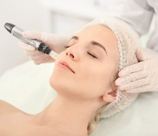 treatment session for melasma