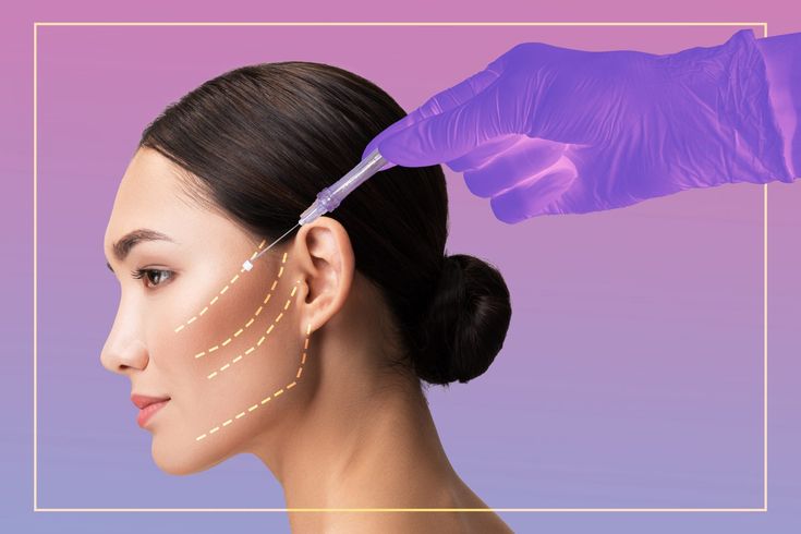HIFU Facelifting