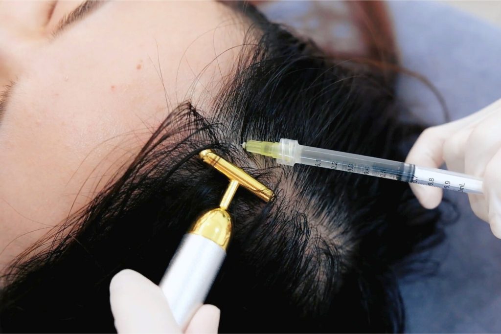 A.M Hair Loss