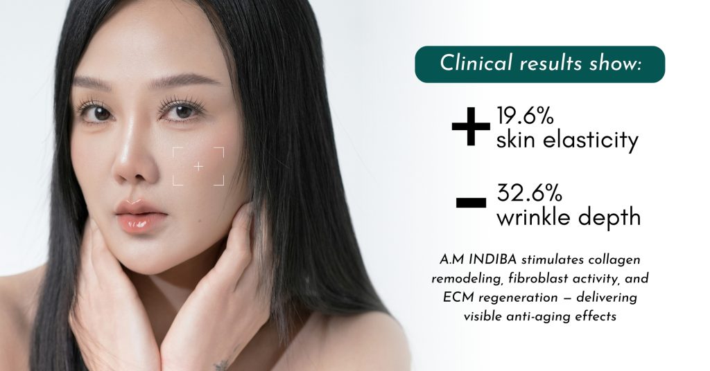 Close-up of woman with smooth skin promoting indiba treatment